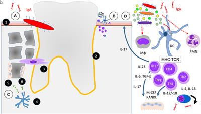 Infectious Triggers in Periodontitis and the Gut in Rheumatoid Arthritis (RA): A Complex Story About Association and Causality